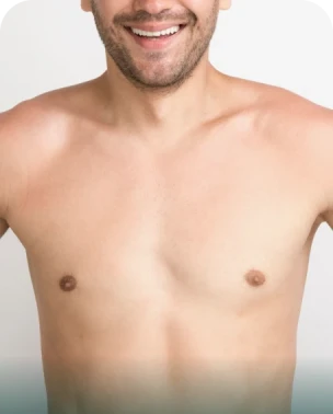 Gynecomastia (to Reduce Male Breast Size)