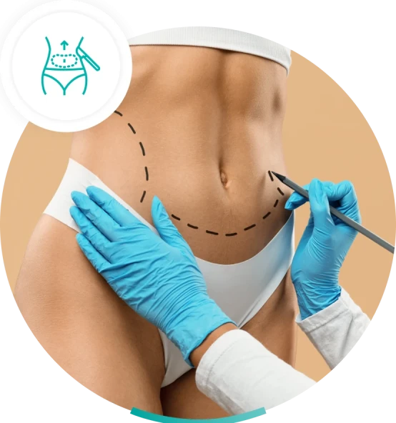 liposucción en Ribeirão Preto