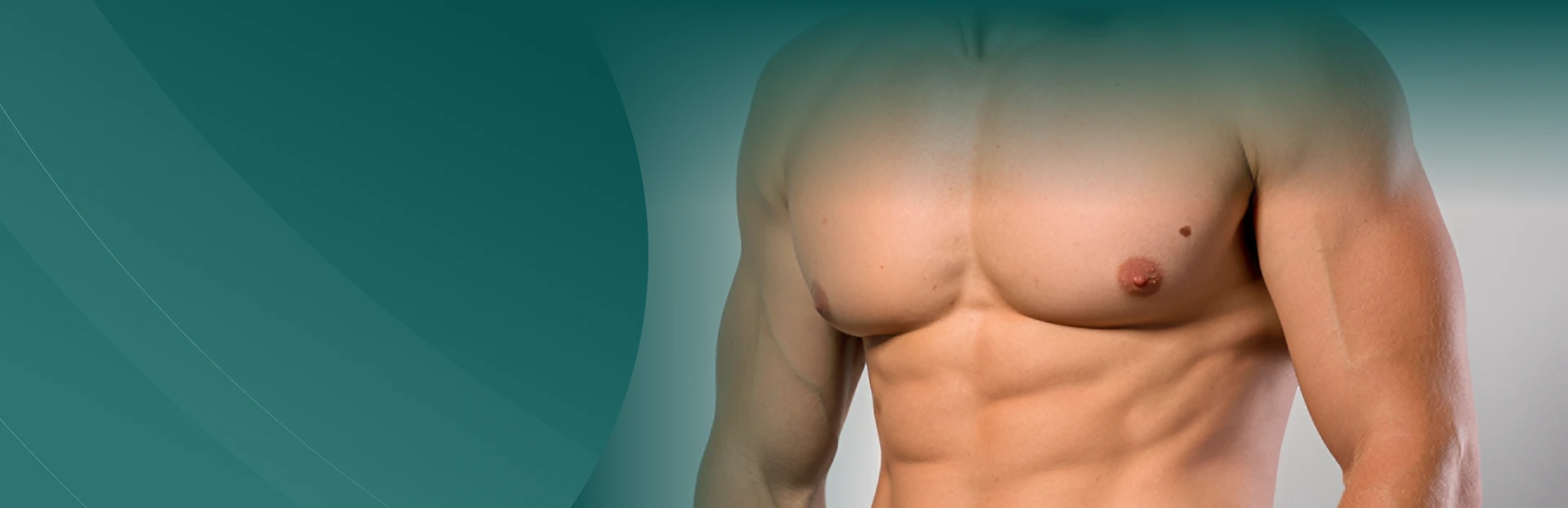 Pr&oacute;tesis de&nbsp;Pectoral masculino