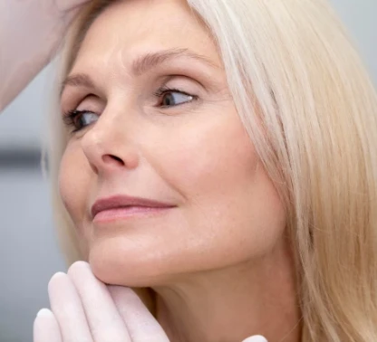 Ritidoplastia (Cirugía plástica facial)