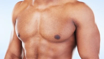 Silicona pectoral masculina: cómo funciona y quién puede colocársela