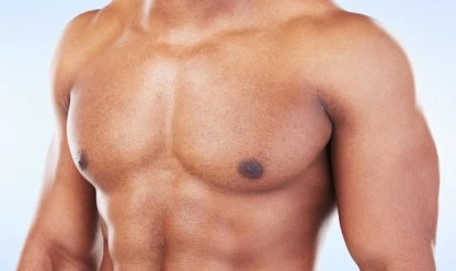 Silicona pectoral masculina: cómo funciona y quién puede colocársela